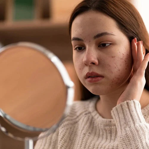 How To Reduce Dark Spots On Face: An Expert Guide