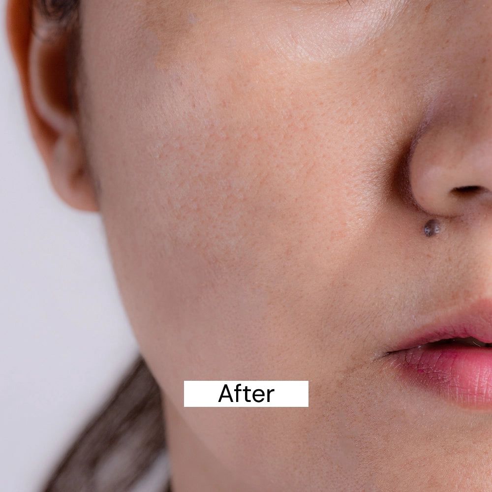 After Use Pigmentation Cream