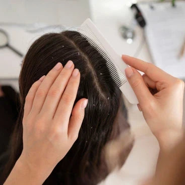 Scalp Buildup in Summer: Signs, Causes & Cure
