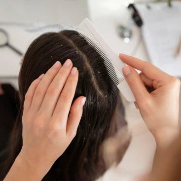 Scalp Buildup in Summer