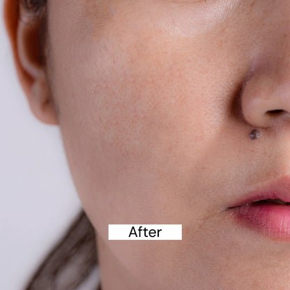 After Use Pigmentation Cream 