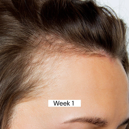 Before Shampoo Using 1 Week 