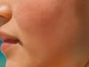 How To Reduce Dark Spots On Face: An Expert Guide